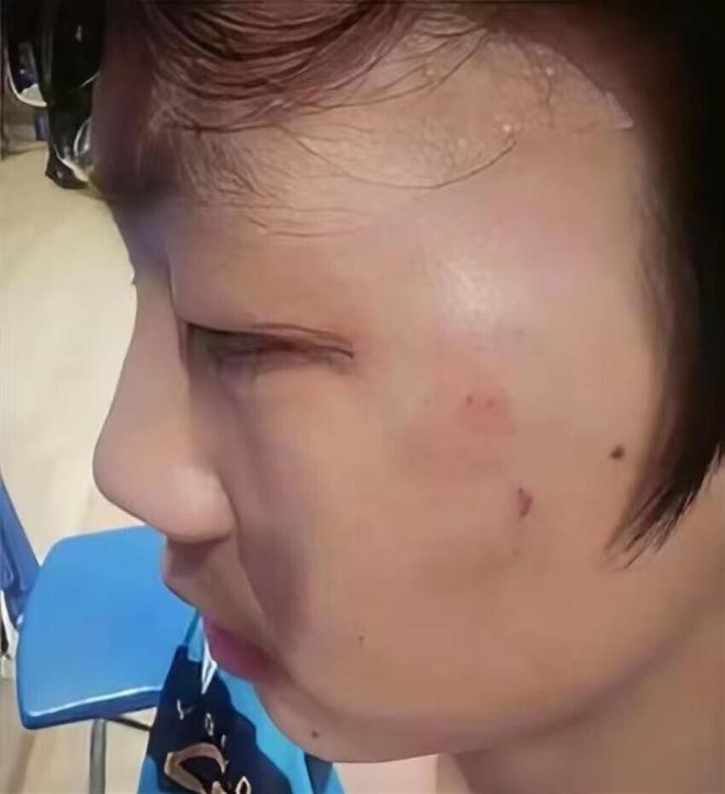 一个陈皮一个它,被称为“化脂黄金”,连喝30天,肚子平了血脂降